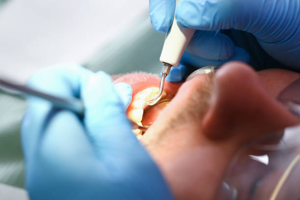 Best Walk-In Emergency Dentist in Winfield, WV